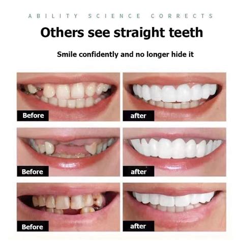 pustiso teeth.